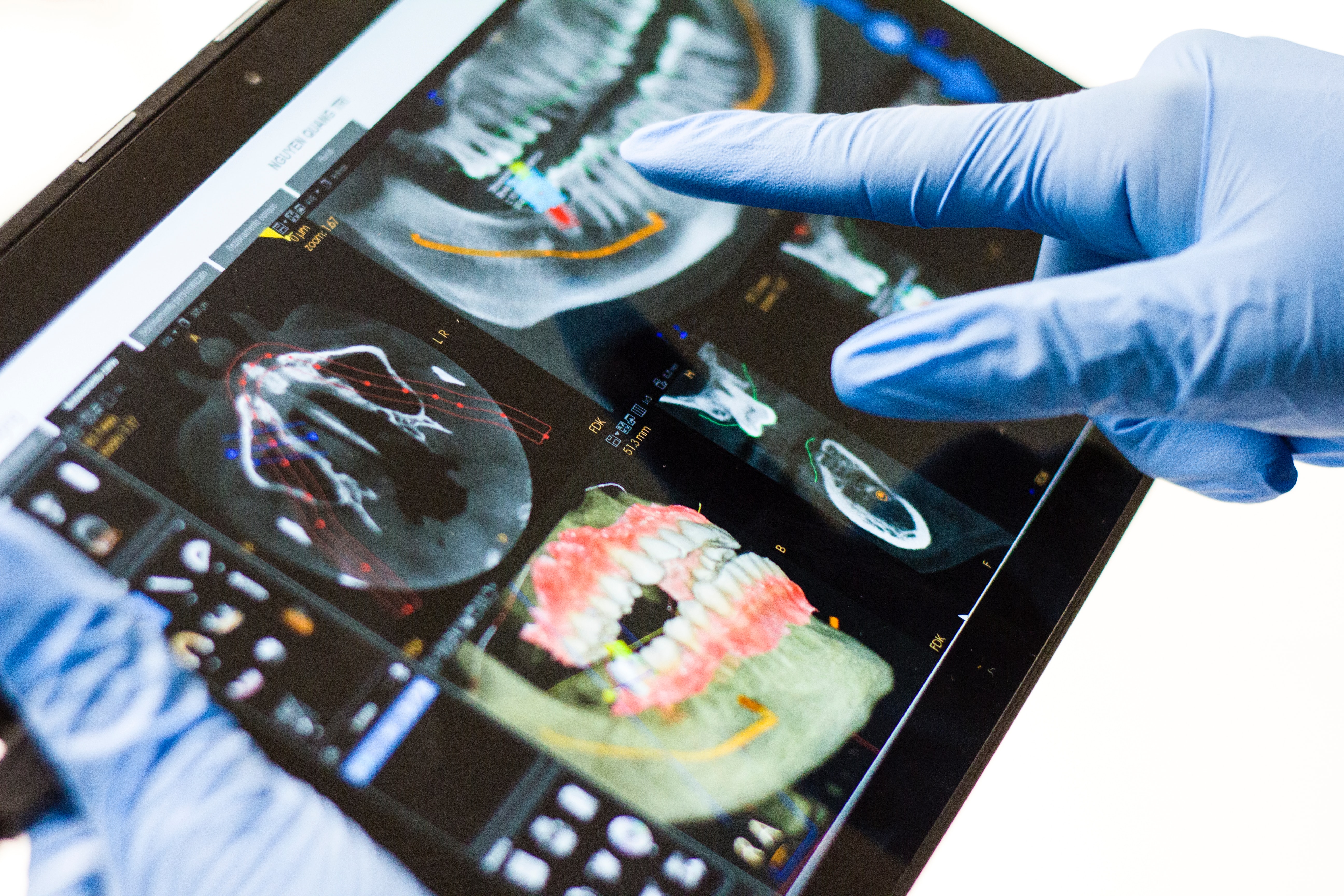 How to Successfully Transition into Digital Dental Technology